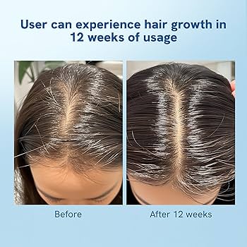 HairNova Root Revival Serum